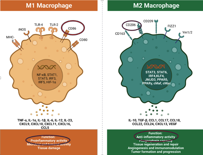 synovitis -macrophage caused inflammation